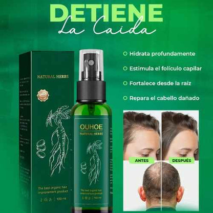 Ouhoe tónico para el crecimiento capilar