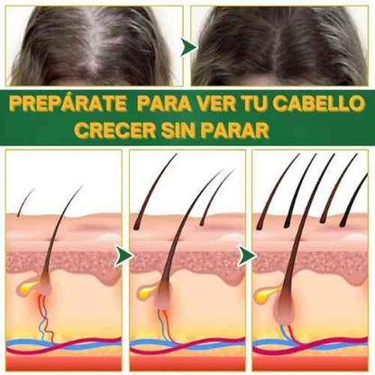 Ouhoe tónico para el crecimiento capilar